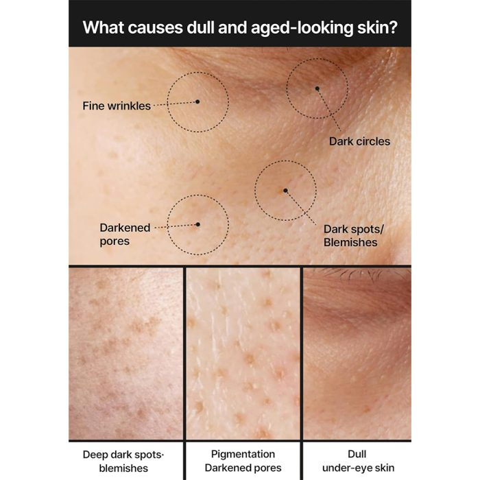 کرم ضد لک و کنترل منافذ سلیمکس روشن کننده پوست Celimax Pore+Dark Spot Brightening Cream