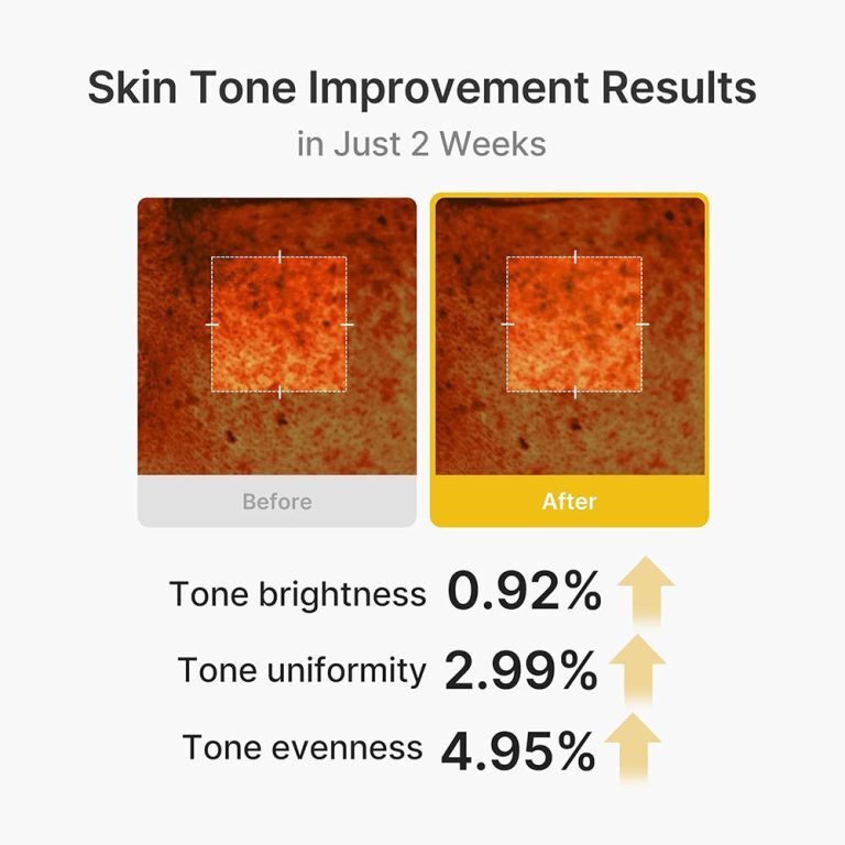  کرم کپسولی کوجیک اسید و زردچوبه مدی کیوب روشن کننده و تسکین دهنده قوی پوست Medicube Kojic Acid Turmeric Vita Capsule Cre 
