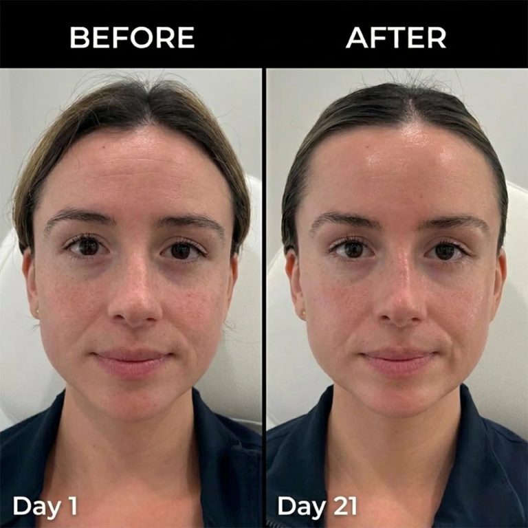  مولتی بالم PDRN و کلاژن مدی کیوب ضد چروک، ترمیم کننده و لیفت کننده پوست Medicube PDRN Pink Collagen Volume Multi Balm 