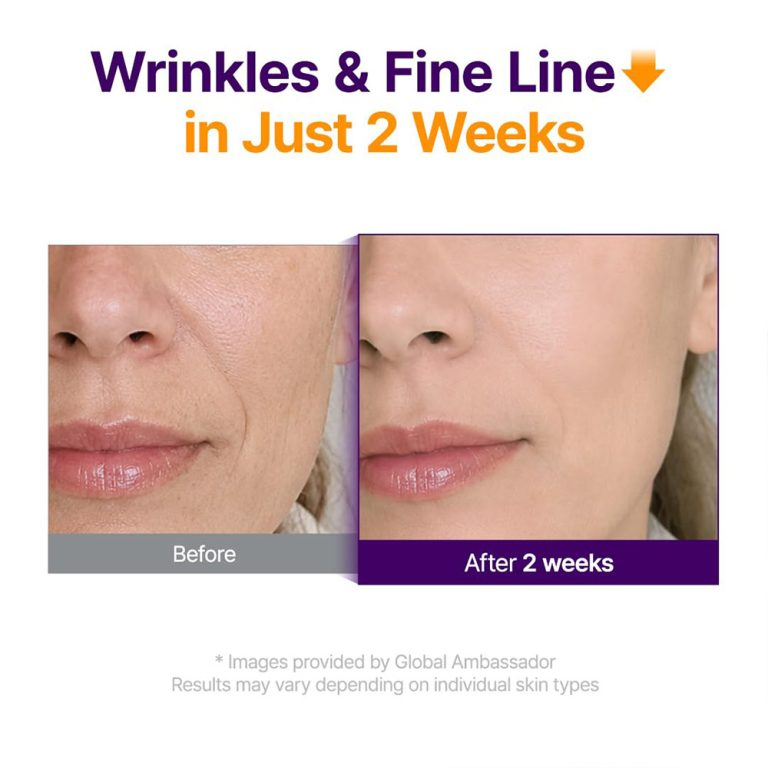  سرم ضد چروک و جوانساز رتینول رتینال 2000 و +NAD پیوریتو Purito SEOUL Retinol Retinal 2000 NAD+ Serum 