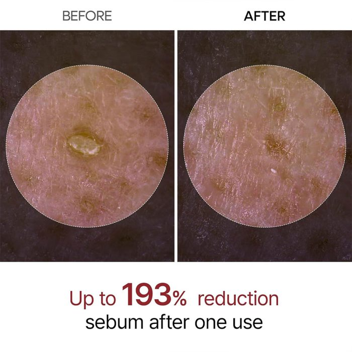  آمپول پیل شات برنج دکتر ملاکسین لایه بردار و روشن کننده پوست Dr.Melaxin Peel Shot Glow White Rice Peeling Ampoule 