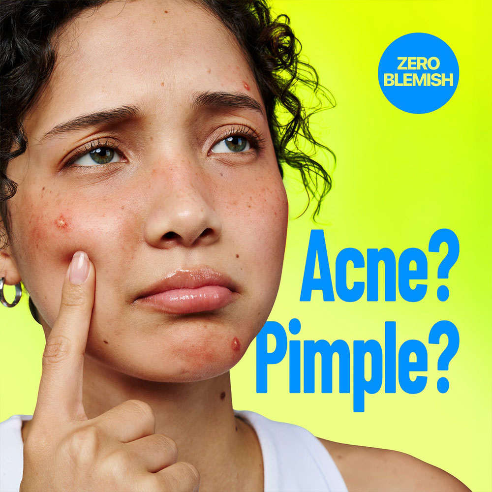کرم ضد جوش فوری و اصلاح لک زیرو بلمیش نامبوزین numbuzin Zero Blemish 3X Spot Correcting Cream