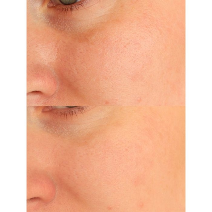  ژل شستشوی روشن کننده و تسکین دهنده کپسولی اسکین 1004 SKIN1004 Madagascar Centella Tone Brightening Cleansing Gel Foam 