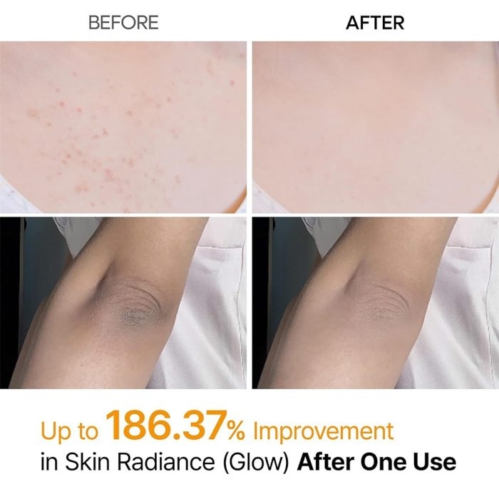 اسپری پیل شات کوجیک اسید دکتر ملاکسین لایه بردار و روشن کننده بدن Dr.Melaxin Peel Shot Exfoliating Kojic Acid Turmeric S 