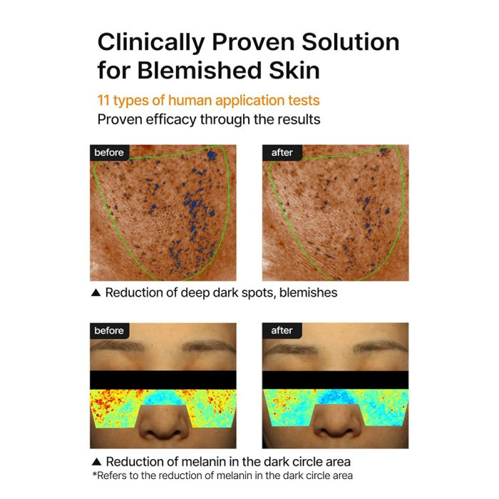 کرم ضد لک و کنترل منافذ سلیمکس روشن کننده پوست Celimax Pore+Dark Spot Brightening Cream