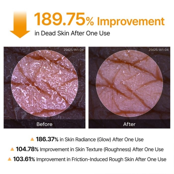  اسپری پیل شات کوجیک اسید دکتر ملاکسین لایه بردار و روشن کننده بدن Dr.Melaxin Peel Shot Exfoliating Kojic Acid Turmeric S 
