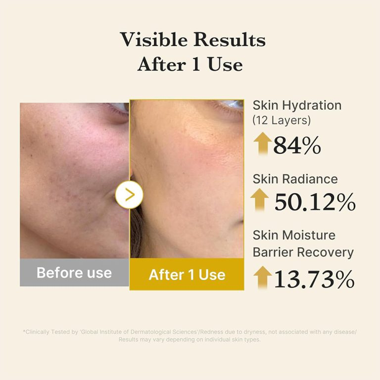  میست سرم ژلی کوجیک اسید و زردچوبه مدی کیوب روشن کننده و تسکین دهنده پوست Medicube Kojic Acid Turmeric Vita Jelly Mist Se 