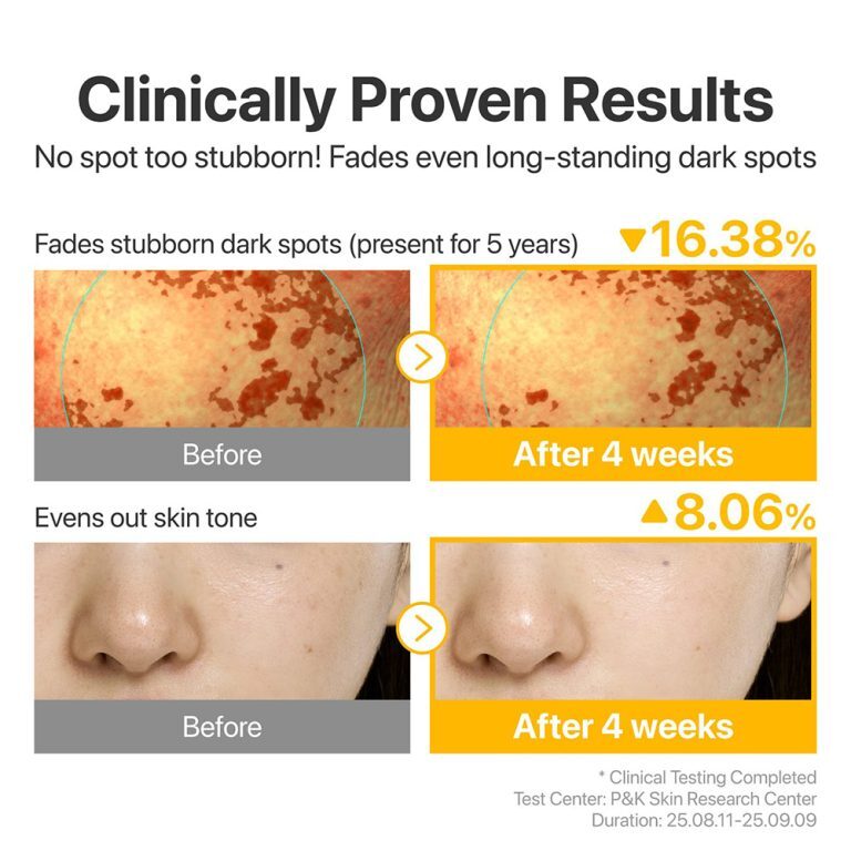 سرم پیشرفته گلوتاتیون و TXA شماره 5 نامبوزین ضد لک و روشن کننده قوی پوست Numbuzin No.5 Glutathione TXA Advanced Dark Spo