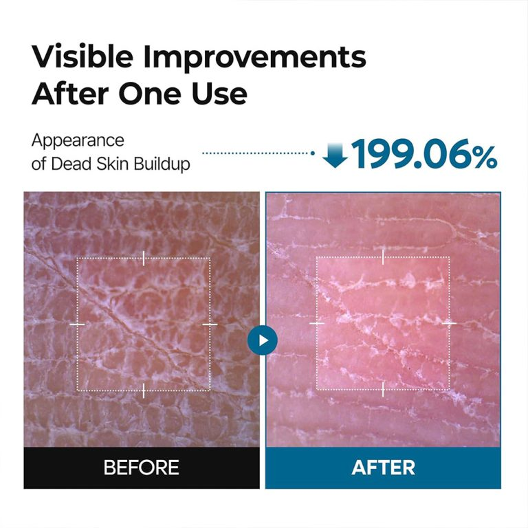  اسپری پیل شات بدن ترانگزامیک اسید دکتر ملاکسین روشن کننده و لایه بردار ملایم Dr.Melaxin Peel Shot Exfoliating TX-Spray 