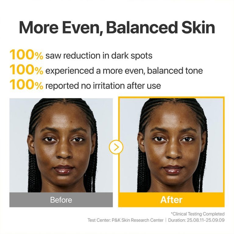 سرم پیشرفته گلوتاتیون و TXA شماره 5 نامبوزین ضد لک و روشن کننده قوی پوست Numbuzin No.5 Glutathione TXA Advanced Dark Spo