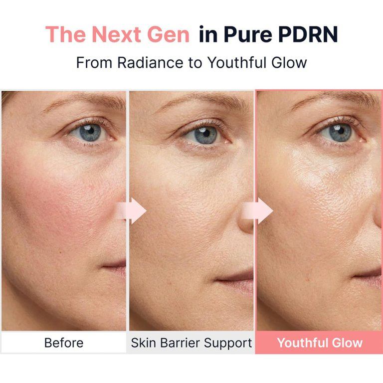  آمپول ویتامینه PDRN سانگ بون ادیتور روشن کننده و جوانساز پوست SUNGBOON EDITOR PDRN Pink Vitamin Glow Boosting Ampoule 